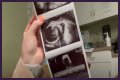 Counting On Alum Joy-Anna Forsyth Updates At 33 Weeks Pregnant